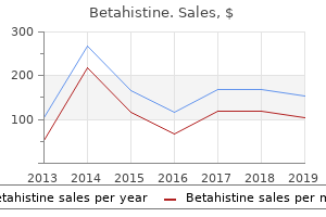 buy betahistine 16mg online