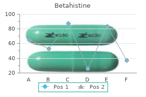 betahistine 16 mg with mastercard