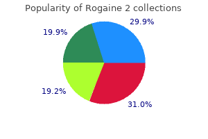 discount 60ml rogaine 2 fast delivery